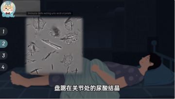 痛风如何让男人痛不欲生？你该如何应对它？
